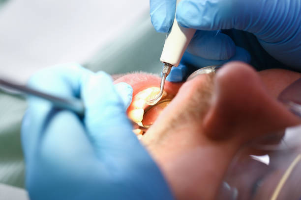 Best Emergency Treatment for Dental Infections or Abscesses in Faison, NC